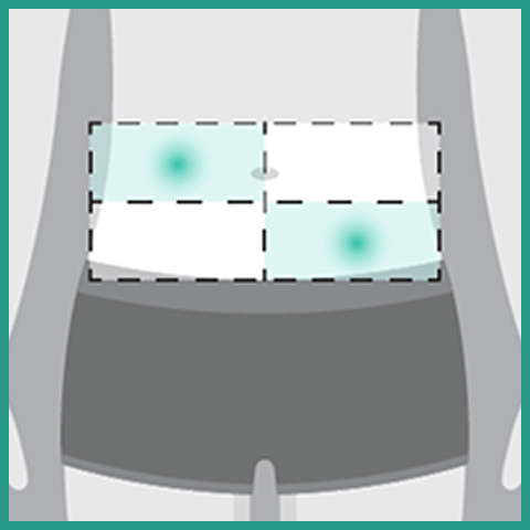 Faspro administration targeting the upper right side of the stomach and bottom left side of the abdomen